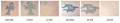 PROFADE 123 Creme Tattoo Entfernung